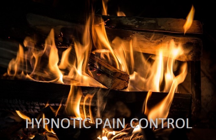 Hypnotic Pain Control